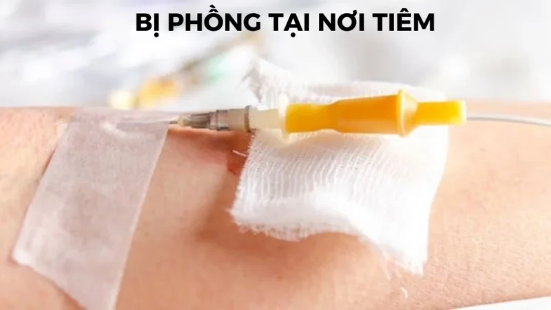 6. Những điều cần biết trước khi thực hiện tiêm tĩnh mạch